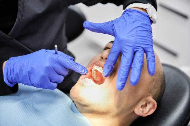 Best Emergency Tooth Extraction in Third Lake, IL